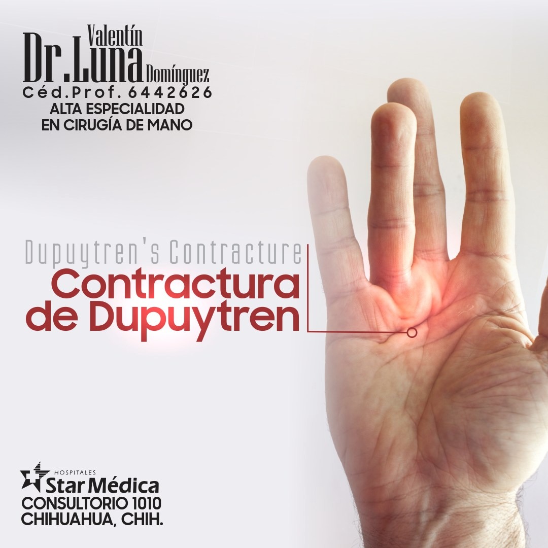 Servicio de cirugía de mano 1