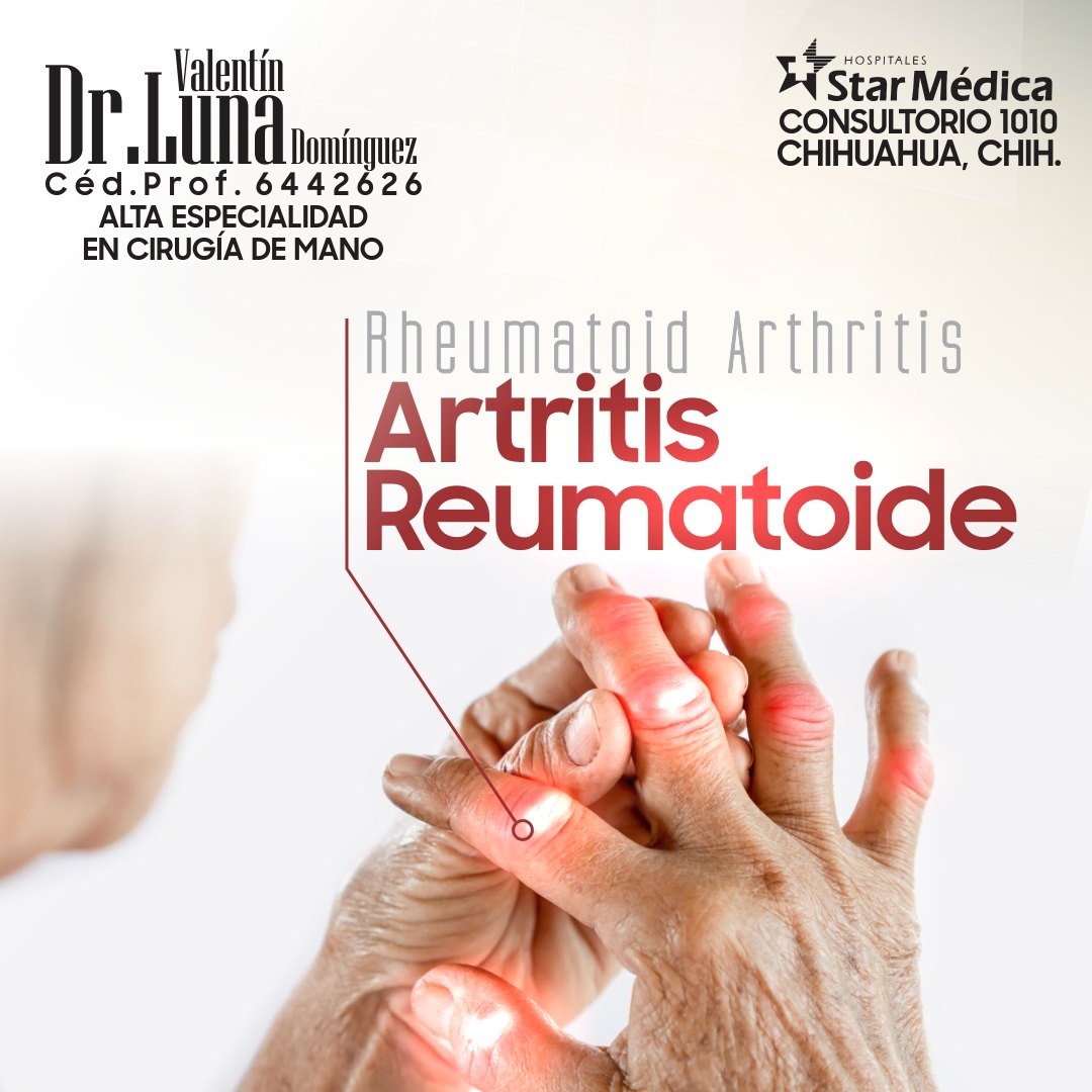 Servicio de cirugía de mano 3
