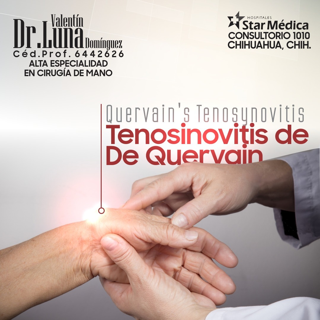 Servicio de cirugía de mano 4