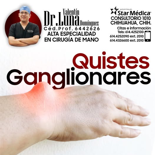 Servicio de cirugía de mano 5