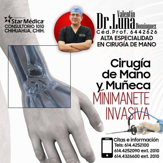 Servicio de cirugía de mano 6